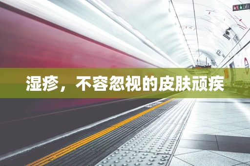 湿疹，不容忽视的皮肤顽疾
