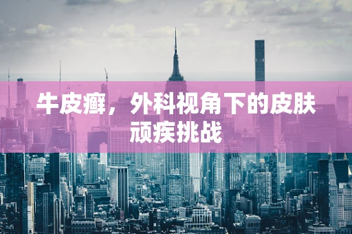 牛皮癣，外科视角下的皮肤顽疾挑战
